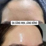hang han clinic cosmetic